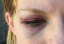 Police ‘brutality’ claim