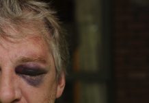 Pensioner bashed, hoon fears grow